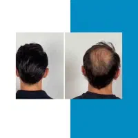 زیبایی موهات به دست بیار