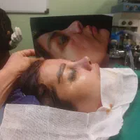 جراحی زیبایی بینی و پلک با تکنیک بدون تامپون|خدمات زیبایی و سلامت|تهران, سهروردی|دیوار