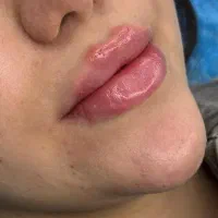 ژل و بوتاکس آنزیم ناخن مژه تاتو