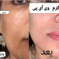 کرم vip تضمینی|آرایشی، بهداشتی، درمانی|رودان, |دیوار