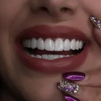 دندانپزشکی کامپوزیت لمینت ایمپلنت لیفت لثه بلچینگ|خدمات آرایشگری و زیبایی|مشهد, سجاد شهر|دیوار