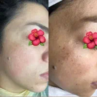 تخفیف ویژه همراه اشناتیون