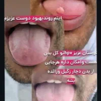 درمان ریشه ای تبخال و زگیل تناسلی با گیاهان دارویی|خدمات آرایشگری و زیبایی|اهواز, گلستان|دیوار