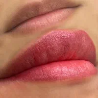 چرا مرکز تخصصی فیبروز هانیه جعفری