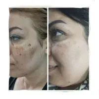 پاکسازی کبد فقط در ۴۰ روز|خدمات آرایشگری و زیبایی|گنبد کاووس, |دیوار