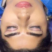 پزشک جراحی بلفا غبغب نخ لیفت کلاژن آنزیم ژل فیلر|خدمات آرایشگری و زیبایی|کرج, گوهردشت|دیوار