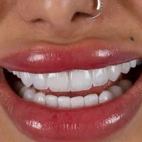 دندانپزشکی اقساطی