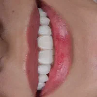 قالب ریز و فریم زن خانم
