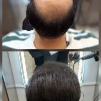 پروتز موی طبیعی و حرفه ای ویژه آقایان و بانوان|خدمات آرایشگری و زیبایی|کرمانشاه, |دیوار