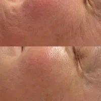 مرکز تخصصی پاکسازی صورت|خدمات آرایشگری و زیبایی|جم, |دیوار