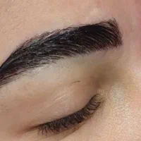 کاشت ابرو ،مو،ریش،شقیقه در شیراز