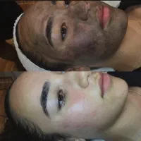 ریمو تتو ابرو،بدن کربن تراپی بادستگاه پیشرفته‌|خدمات آرایشگری و زیبایی|اهواز, کیانپارس |دیوار