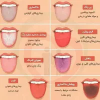 سونوگرافی و تشخیص بیماری های شما از روی زبان|خدمات آرایشگری و زیبایی|مشهد, رضاشهر|دیوار