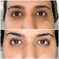 جشنواره آف بای فیلر (سلول های بنیادی)