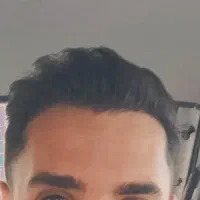 کاشت مو و ابرو قسطی در شیراز