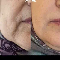 اول مشاوره رایگان انجام میشود