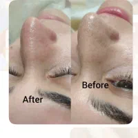 اصلاح درماپلینگ قیمت باورنکردنی|خدمات آرایشگری و زیبایی|بیرجند, |دیوار