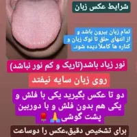 زبان|آرایشی، بهداشتی، درمانی|دیواندره, |دیوار