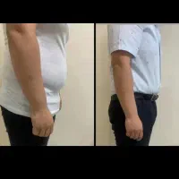 مرکز لاغری بدون برگشت