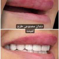 دندان مصنوعی تخصص ماست..|خدمات آرایشگری و زیبایی|پردیس, فاز ۸|دیوار