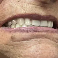 ساخت انواع دندان مصنوعی + لابراتوار دندانساری|خدمات آرایشگری و زیبایی|تهران, یافت آباد جنوبی|دیوار