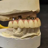 کارآموز لابراتوار دندان سازی