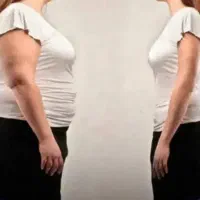 خدمات لیپو و ابدومینو‌پلاستی