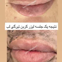 زیبایی|خدمات آرایشگری و زیبایی|یاسوج, |دیوار