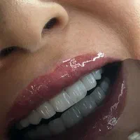 قیمت کامپوزیت فقط8میلیون با ضمانت ده ساله (تهران)