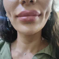 آموزش و ارائه خدمات پیرسینگ ومیکرودرمال چال لپ
