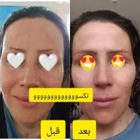 مثل کره چربی سوزی کن|آرایشی، بهداشتی، درمانی|مشهد, دانشجو|دیوار