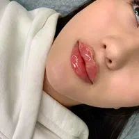 ژل لب ۶۵۰بوتاکس آنزیم لب زاویه فک گونه کانتورینگ|خدمات آرایشگری و زیبایی|شیراز, منطقه هوایی شهید دوران|دیوار