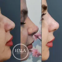 خدمات زیبایی صورت|خدمات آرایشگری و زیبایی|آبادان, |دیوار