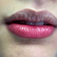 مدل رایگان میکروبلیدینگ وفیبروز  ابرو