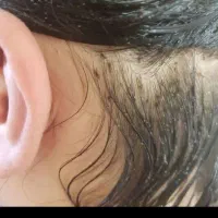 محلول گیاهی رشک و شپش|آرایشی، بهداشتی، درمانی|کرج, شهرک بنفشه|دیوار