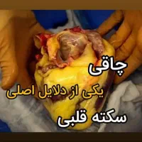 تخفیفات ویژه لیپوماتیک و ابدو و اسلیو اقساطی|خدمات آرایشگری و زیبایی|تهران, میدان ولیعصر|دیوار