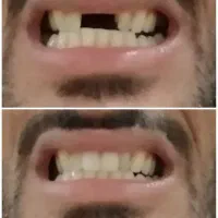 ت خفیف ویژه در طرح به زیبایی لبخند|آرایشی، بهداشتی، درمانی|یزد, |دیوار