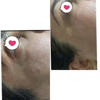 مرکز زیبایی نوژا (تخفیف پلاژن تراپی و میکروکارنت )|خدمات آرایشگری و زیبایی|جهرم, |دیوار