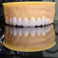 دندانسازی متحرک و ثابت