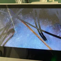 آموزشی ان لاین  اسکراب اسکالپ تخفیف ویژه|خدمات آموزشی|فریمان, |دیوار