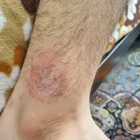مشاوره درمانی|خدمات آرایشگری و زیبایی|شیراز, حافظیه|دیوار