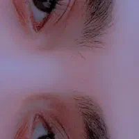 کاشت مژه موقت