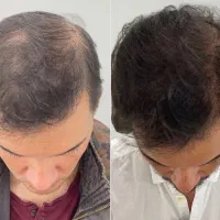 اگه می‌خوای موهات مثل هندیا بشه پیام بده