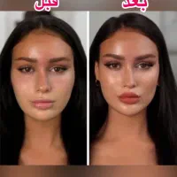 تخفیفات کلینیک فوق تخصصی تزریق فیلر و بوتاکس