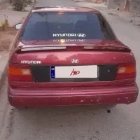 هیوندای اکسل تمیز و روپا