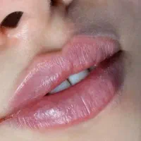 ژل و بوتاکس