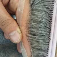 پروتز مو|خدمات آرایشگری و زیبایی|فردیس, طالقانی|دیوار