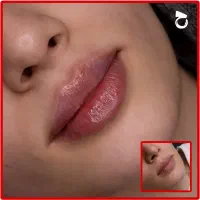 تخفیفات ۵۰ درصدی ژل و بوتاکس و فیلر دکتر زیبایی|خدمات آرایشگری و زیبایی|مشهد, شهید فرامرز عباسی|دیوار