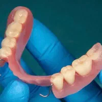 درمان پروتز پارسیل رایگان