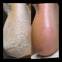 پدیکور کفسابی پارافین تراپی دست و پا